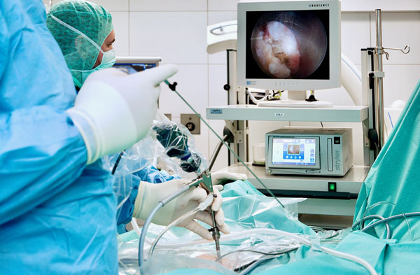Minimalinvasive Wirbelsäulen OP Arthroskopische Wirbelsäulen OP