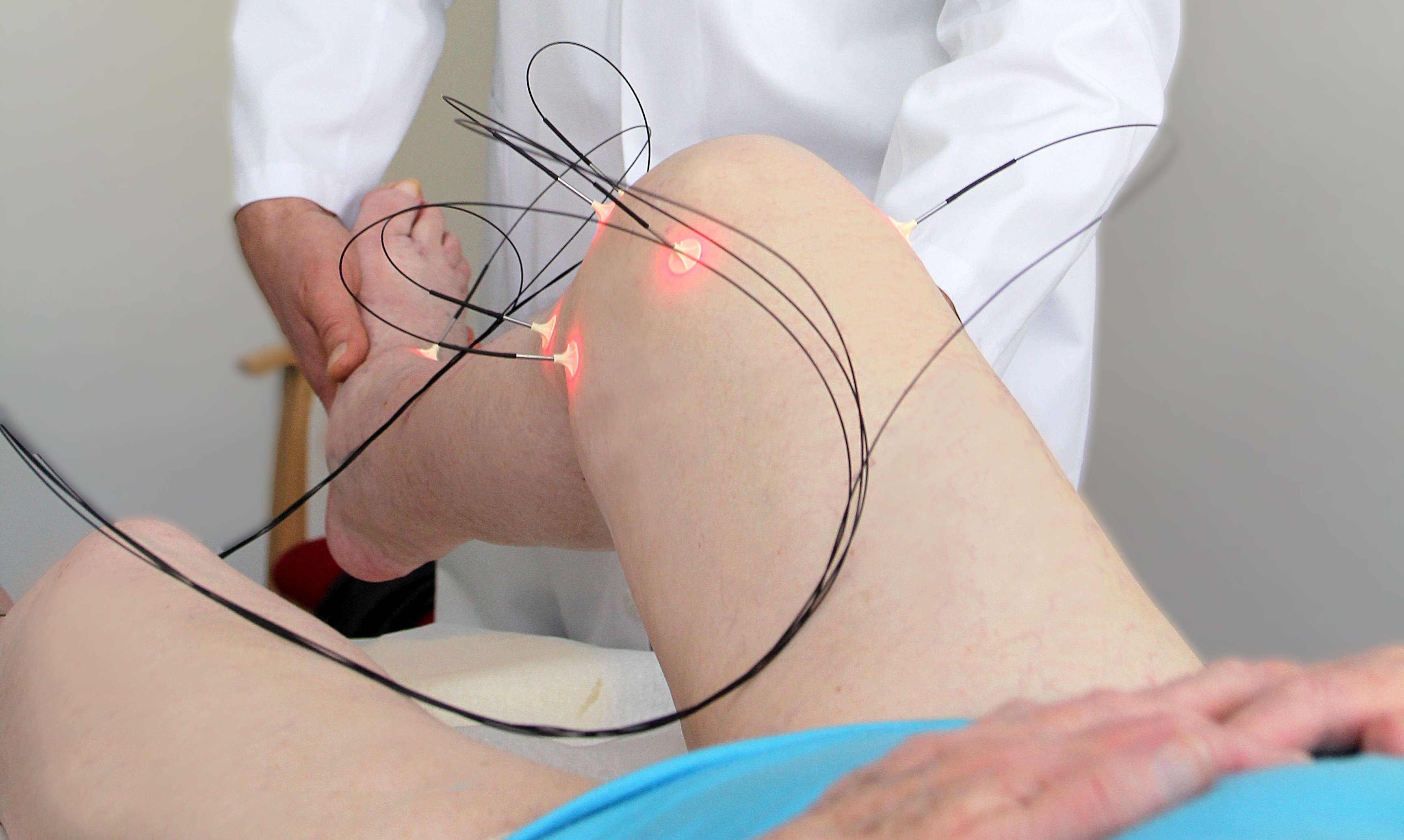 Laserakupunktur Akupunktur mit Laser