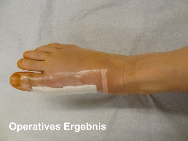 operative Ergebnis UCHoperative Ergebnis_72