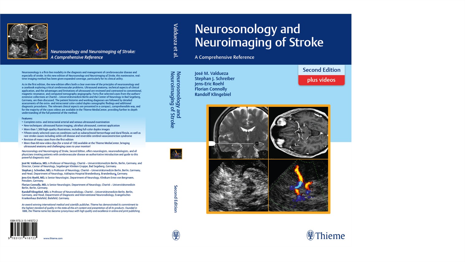 Neurosonology and Neuroimaging of Stroke Neurosonology and Neuroimaging of Stroke