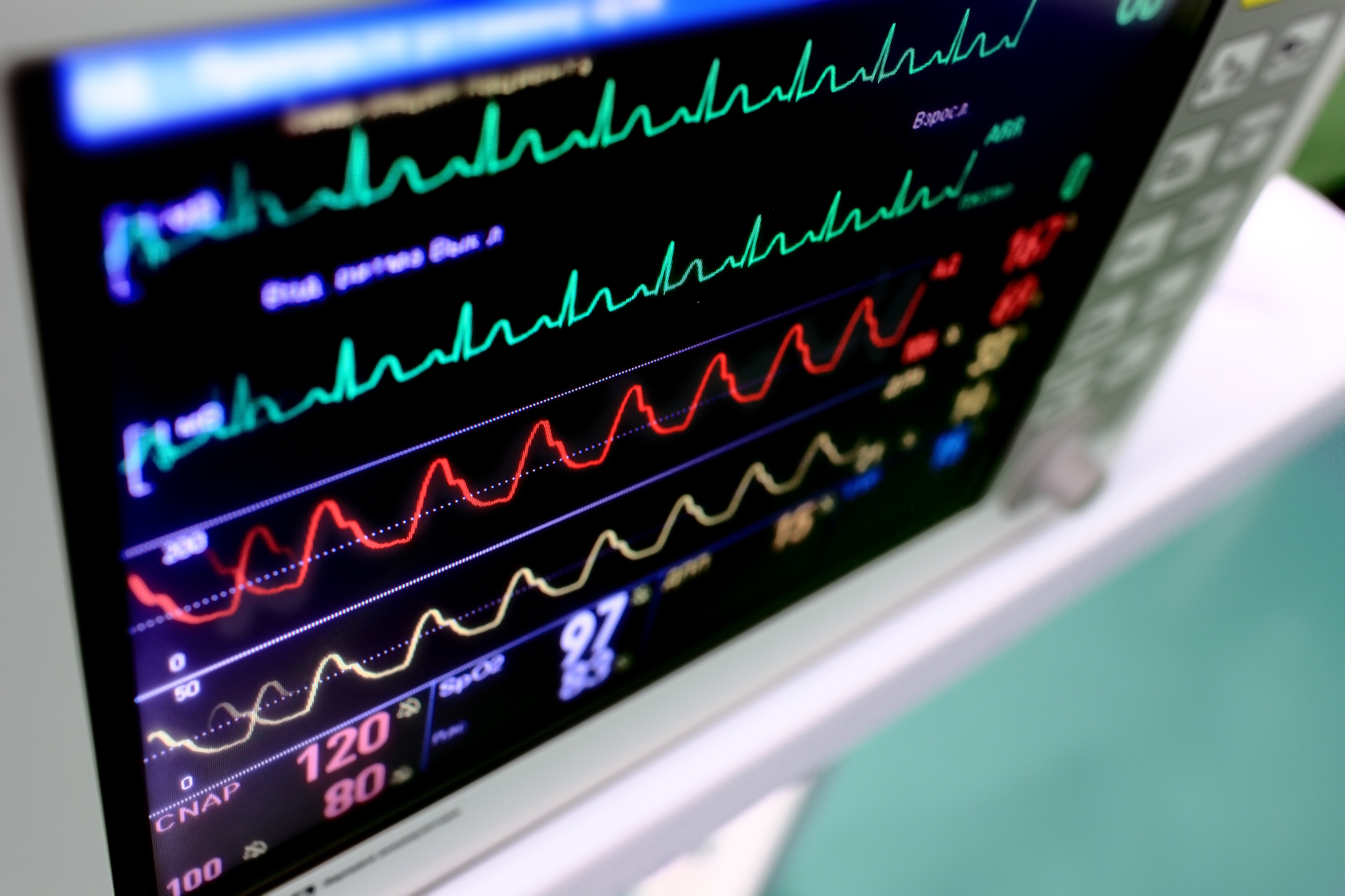 EKG Monitor EKG Monitor 1 Daten Fakten