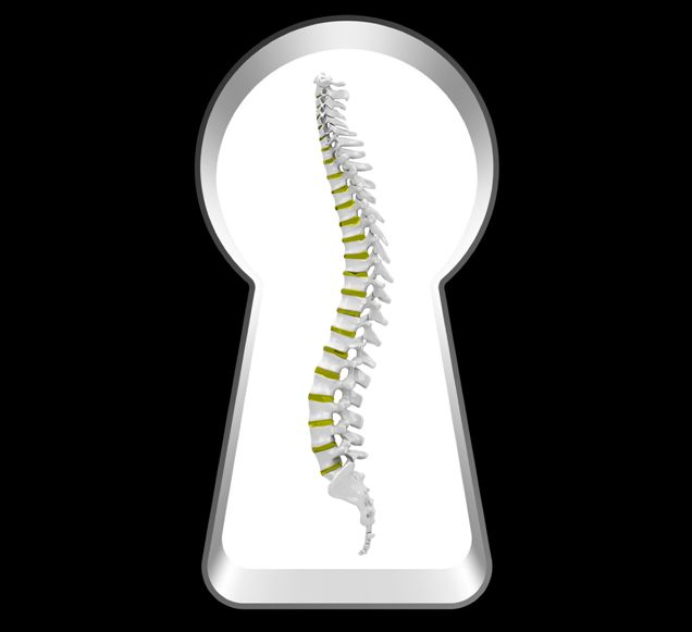 Minimalinvasive Operation awsc wirbelsäule schlüsselloch